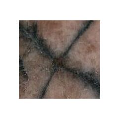 Chiastolith